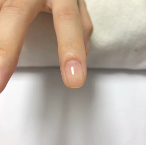 Gel modelador MPA